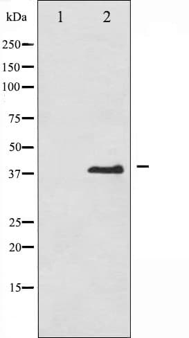 Polyclonal Rabbit anti-Human EIF2S1 Antibody (phospho-Ser51, IHC, IF, WB)