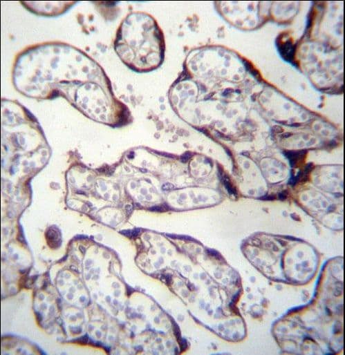 Polyclonal Rabbit anti-Human LOXL3 Antibody (aa715-744, IHC, WB)