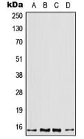 IHC-plus™ Polyclonal Rabbit anti-Human PFN2 / Profilin 2 Antibody (Internal, IHC, WB)