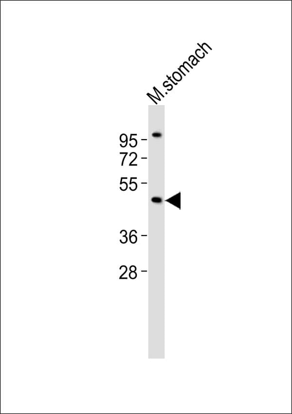 ARRDC1 Antibody