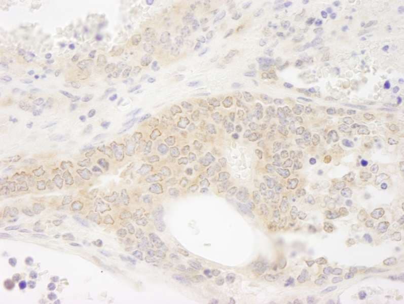 Polyclonal Rabbit anti-Human DDX19B Antibody (aa450-C-term, IHC)