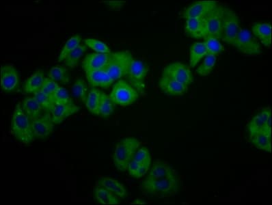 KIR3DS1 / NKB1 Antibody
