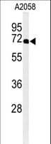 XRCC6 / Ku70 Antibody (aa521-548)