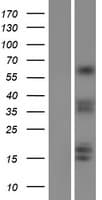 CRTC1 / MECT1 / TORC1 Protein (Over-Expression Lysate Myc-DDK (Flag))