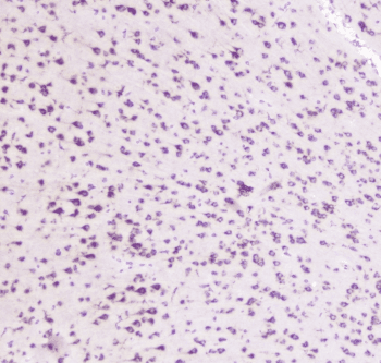 Polyclonal Rabbit anti-Human GOLGA2 / GM130 Antibody (IHC, WB)