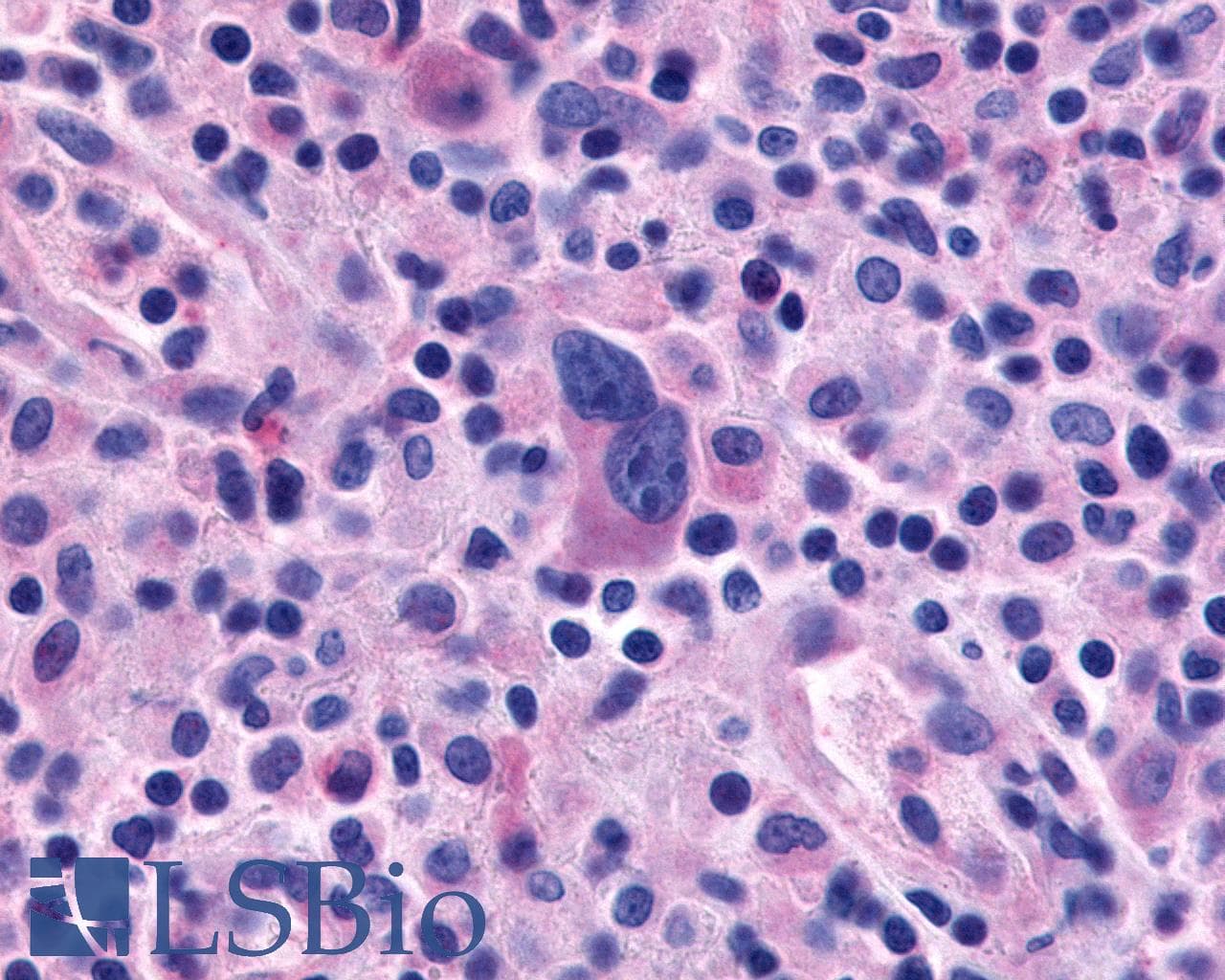 IHC-plus™ Polyclonal Rabbit anti-Human ADGRE1 / EMR1 Antibody (C-Terminus, IHC)