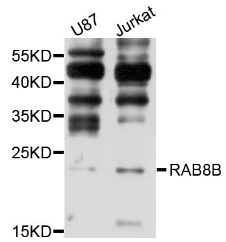 RAB8B Antibody