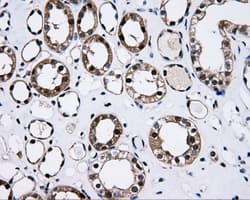 HDHD2 Antibody (clone OTI2C12)
