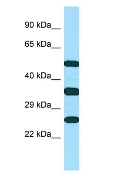 NKG2DL4 / ULBP4 Antibody (aa177-226)