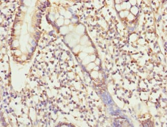 Polyclonal Rabbit anti-Human USP26 Antibody (IHC, WB)