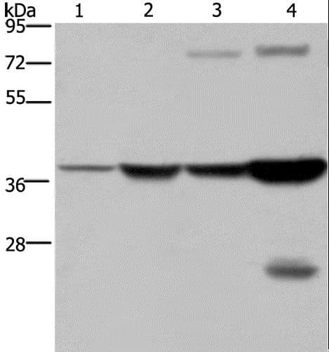 FBP1 Antibody