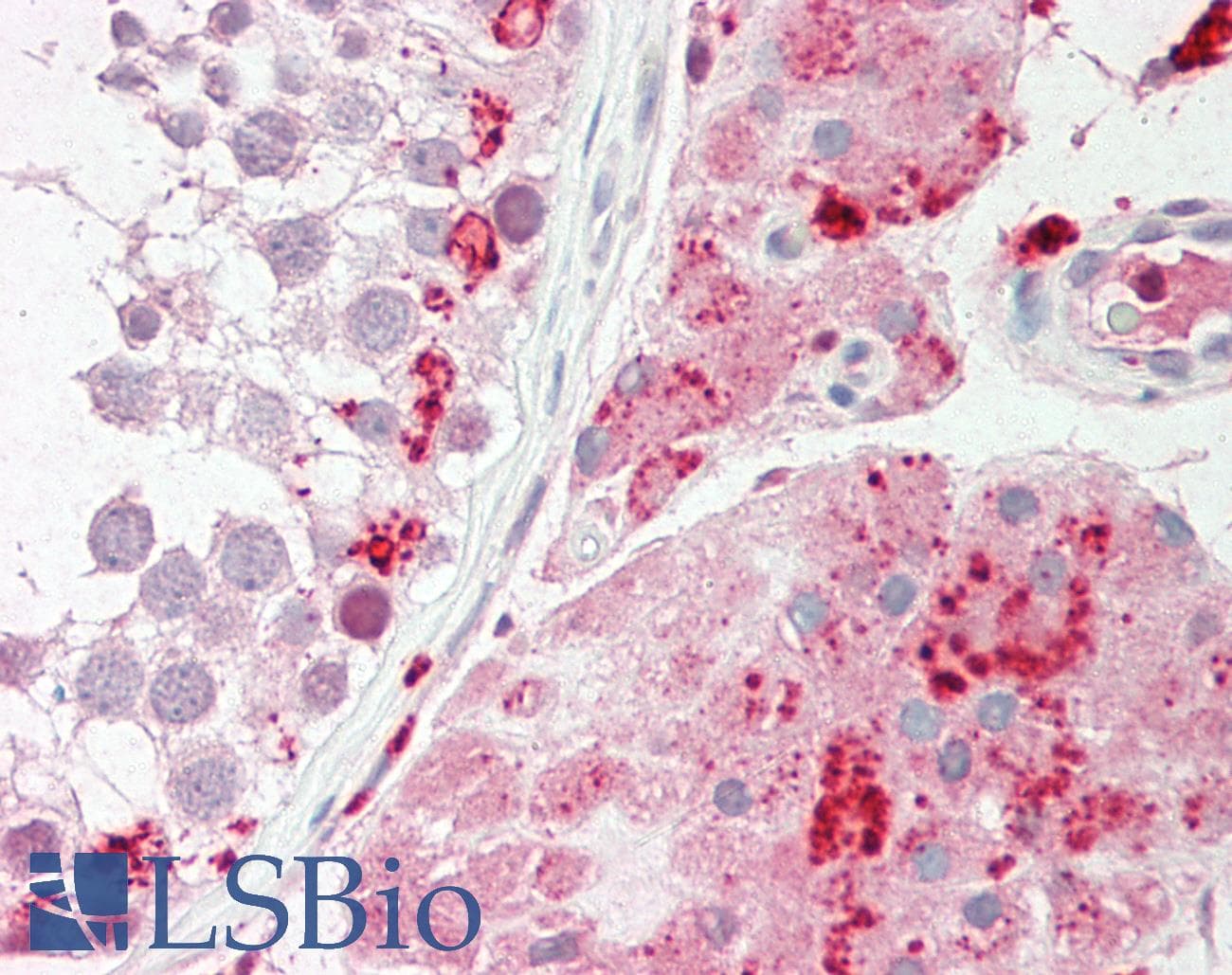 SMARCB1 / INI1 Antibody (aa40-89, Biotin)