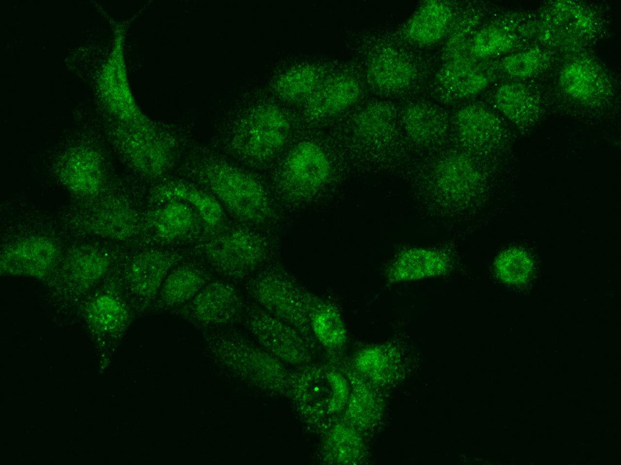 DACH / DACH1 Antibody