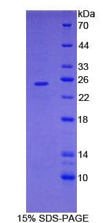 Mouse FR4 / Folate Receptor 4 Protein (Recombinant His)
