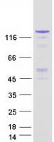 Human KDM3A / JMJD1A Protein (Recombinant Myc-DDK (Flag))