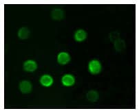 Monoclonal Mouse anti-Human CD20 Antibody (clone 3E9D3C1G3, IHC, IF)