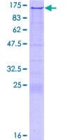 Human RNF74 / RAG1 Protein (Recombinant GST)