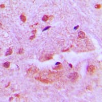 BHLHE41 / BHLHB3 / SHARP1 Antibody (N-Terminus)