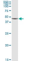 IHC-plus™ Monoclonal Mouse anti-Human CDKL1 Antibody (clone 5B11, IHC, IF, WB)