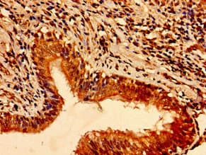 Polyclonal Rabbit anti-Human TFAP2C / AP2 Gamma Antibody (IHC)