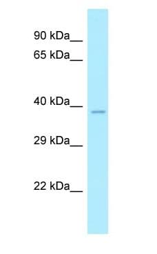 CLP1 Antibody (aa264-313)
