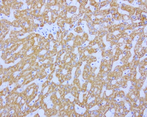 ABAT Antibody (aa29-323, clone UMAB178, Carrier-free)