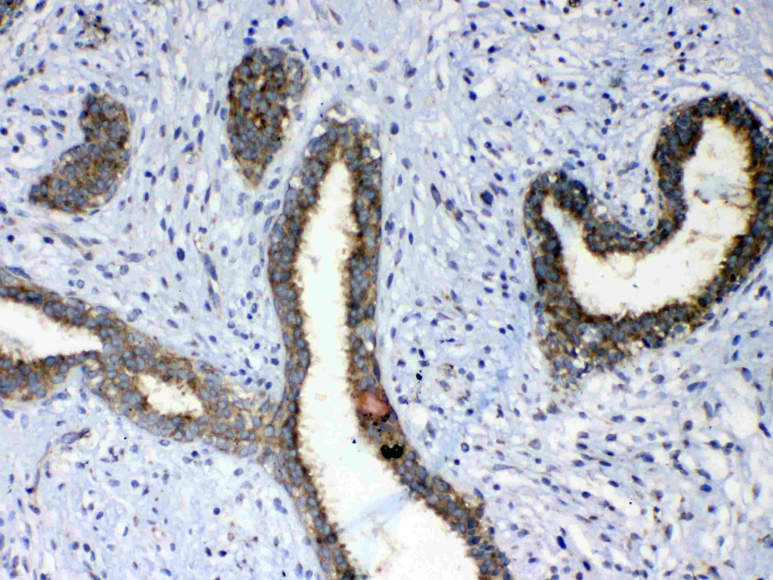 ERBB4 / HER4 Antibody