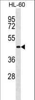 Polyclonal Rabbit anti-Human ATG3 Antibody (aa83-112, WB)