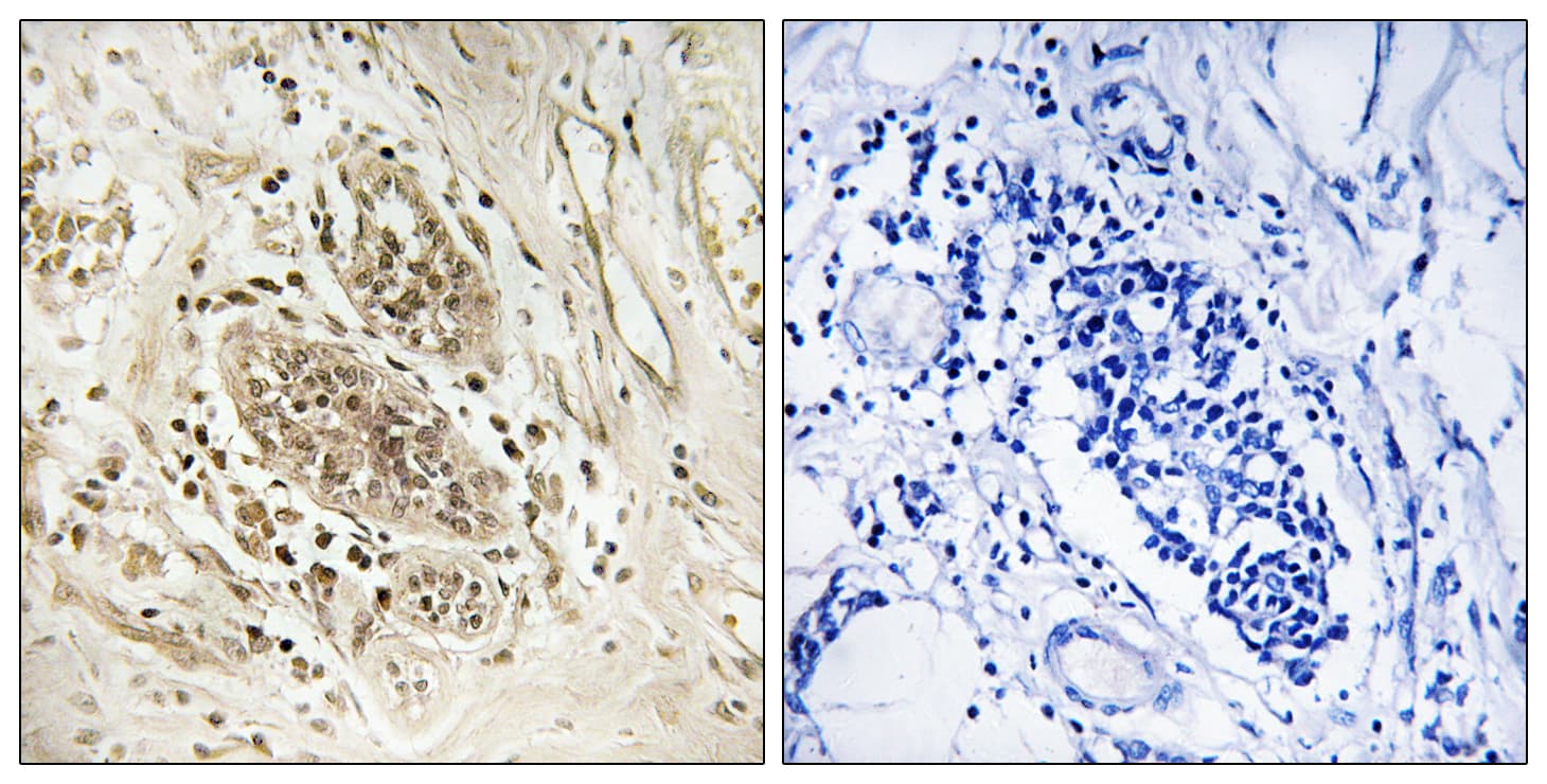 Polyclonal Rabbit anti-Human POLE / POLE1 Antibody (aa1261-1310, IHC)
