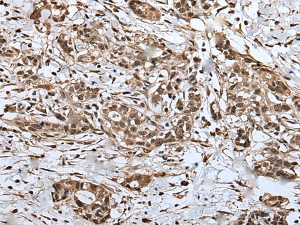 Polyclonal Rabbit anti-Human UPK3A / UPK3 / Uroplakin III Antibody (IHC)