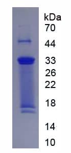 Human Collagen X Protein (Recombinant His, N-Terminal)