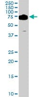 DDX3Y Antibody (clone 2D7)