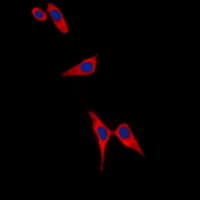 TH / Tyrosine Hydroxylase Antibody (phospho-Ser19)