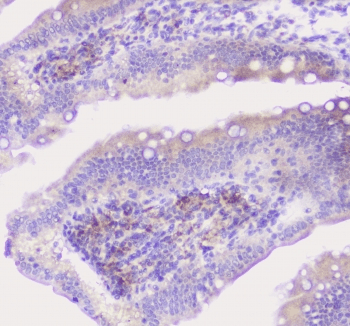 Properdin / CFP Antibody