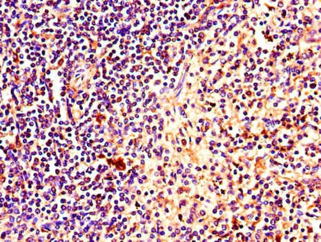 PINK1 Antibody