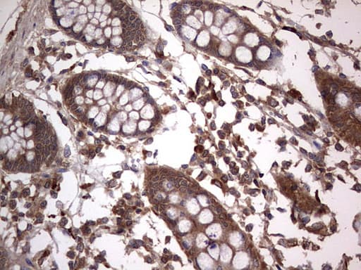Monoclonal Mouse anti-Human ARAF / ARAF1 / A-RAF Antibody (clone OTI2G9, aa145-365, IHC, WB)