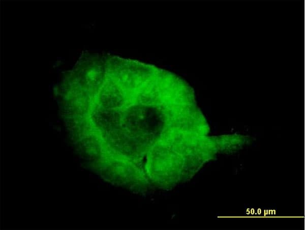 SH3BP2 Antibody (clone 1E9)