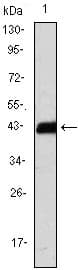 Monoclonal Mouse anti-Human CD247 / CD3 Zeta Antibody (clone 4B10, IHC, IF, WB)