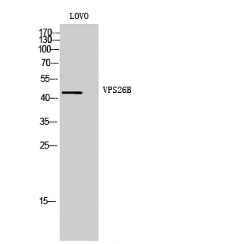 VPS26B Antibody (200-280 aa, Internal)