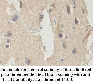 ITIH2 Antibody (aa124-321)