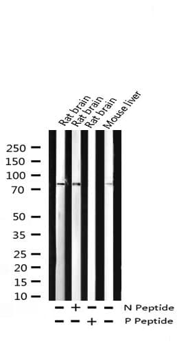 PRKCD / PKC-Delta Antibody (phospho-Tyr313)