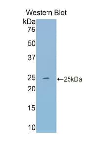 TF / Transferrin Antibody (aa22-176)
