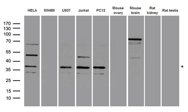 Polyclonal Rabbit anti-Human RAD51 / RECA Antibody (WB)