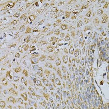 CDA / Cytidine Deaminase Antibody