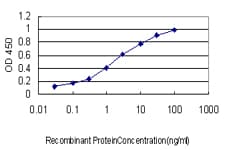 Monoclonal Mouse anti-Human FMR1 / FMRP Antibody (clone 2D4, WB)