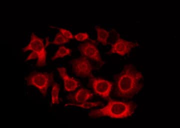 Polyclonal Rabbit anti-Human GPCR6 / GPR101 Antibody (IF, WB)