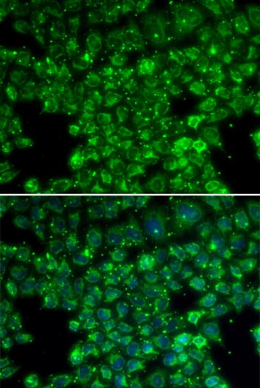 LYZL6 Antibody