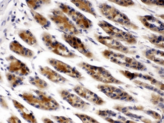 Polyclonal Rabbit anti-Human CCT2 / CCT Beta Antibody (IHC, WB)