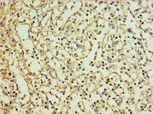 RNF125 / TRAC-1 Antibody (aa1-232)