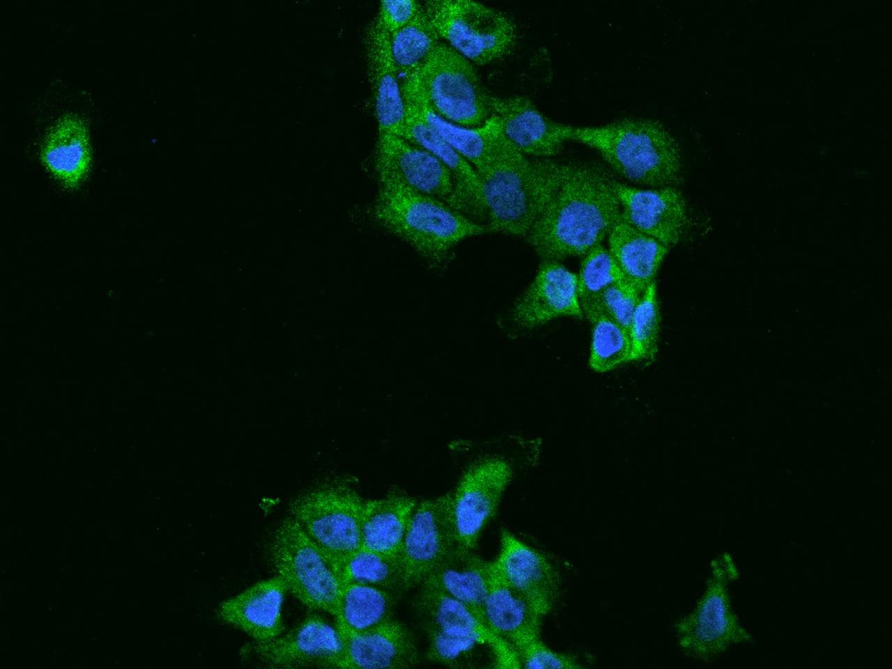 FARSA Antibody